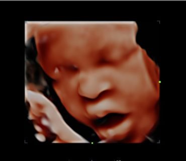 202206301644220066OB-1-1024x727